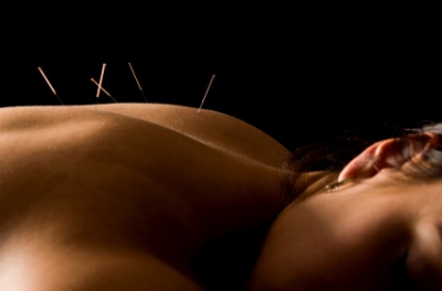 Acupunctura, medicina chineza, beneficiile acupuncturii, tratamente alternative