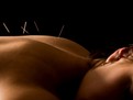 Acupunctura, medicina chineza, beneficiile acupuncturii, tratamente alternative