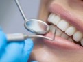 implant_dentar_endodontie_400 implant_dentar_endodontie_400