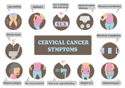 Cancerul de col uterin: cauze, simptome, tratament