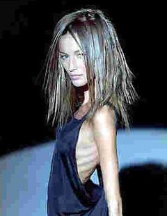 anorexice anorexie slabire fortata