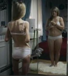 anorexia este periculoasa