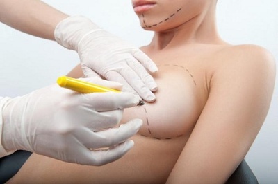ce lucruri trebuie sa stii despre o operatie de ugmentare mamara