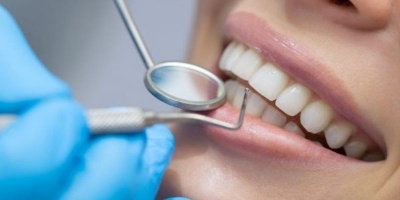 implant_dentar_endodontie_400 implant_dentar_endodontie_400