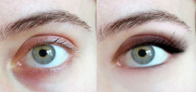 machiaj pentru ochi efoftalmici, cum se machiaza ochii exoftalmici, cum sa faci ochii mai mici prin machiaj, trucuri de make-up pentru ochi exoftalmici