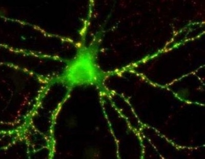 schizofrenia